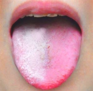 舌苔白